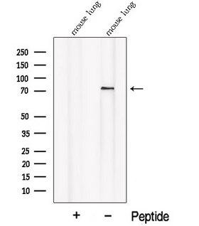 PALMD Antibody - Western blot analysis of extracts of mouse lung tissue using PALMD antibody. The lane on the left was treated with blocking peptide.