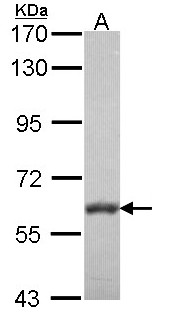 PALS2 / MPP6 Antibody - Sample (30 ug of whole cell lysate). A: NT2D1. 7.5% SDS PAGE. PALS2 / MPP6 antibody diluted at 1:1000.