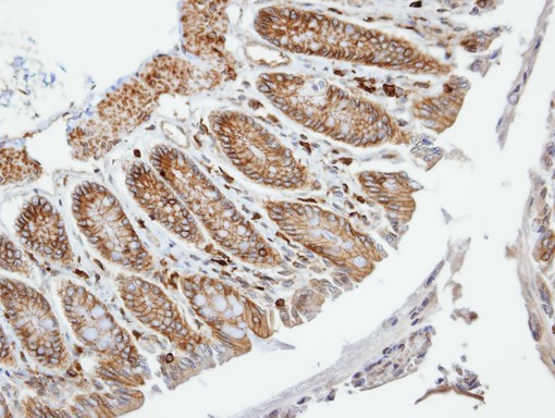 PALS2 / MPP6 Antibody - IHC of paraffin-embedded Colon using VAM1 antibody at 1:100 dilution.