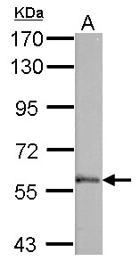 PALS2 / MPP6 Antibody - Sample (50 ug of whole cell lysate). A: mouse brain. 7.5% SDS PAGE. PALS2 / MPP6 antibody diluted at 1:1000.