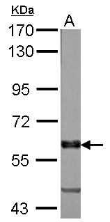 PALS2 / MPP6 Antibody - Sample (50 ug of whole cell lysate). A: Rat brain. 7.5% SDS PAGE. PALS2 / MPP6 antibody diluted at 1:1000.