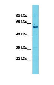 PALS2 / MPP6 Antibody - Western blot of Mouse Testis . Mpp6 antibody dilution 1.0 ug/ml.  This image was taken for the unconjugated form of this product. Other forms have not been tested.