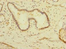 PALS2 / MPP6 Antibody - Immunohistochemistry of paraffin-embedded human pancreatic tissue at dilution 1:100