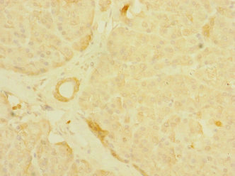 PALS2 / MPP6 Antibody - Immunohistochemistry of paraffin-embedded human pancreatic tissue at dilution 1:100