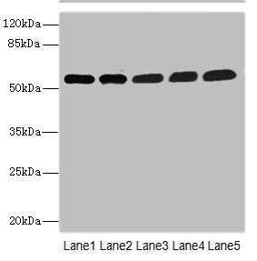 PALS2 / MPP6 Antibody - Western blot All Lanes: MPP6 antibody at 3.58ug/ml Lane 1: Mouse brain tissue Lane 2: Mouse kidney tissue Lane 3: HepG-2 whole cell lysate Lane 4: Hela whole cell lysate Lane 5: A549 whole cell lysate Secondary Goat polyclonal to rabbit IgG at 1/10000 dilution Predicted band size: 61 kDa Observed band size: 61 kDa