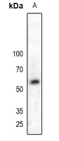 PALS2 / MPP6 Antibody - Western blot analysis of MPP6 expression in HEK293T (A) whole cell lysates.