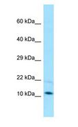 PAM16 Antibody - PAM16 antibody Western Blot of HepG2.  This image was taken for the unconjugated form of this product. Other forms have not been tested.