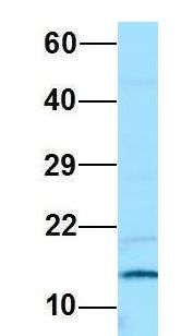 PAM16 Antibody - PAM16 antibody Western Blot of Jurkat lysate. Antibody Dilution: 1.0 ug/ml. PAM16 is supported by BioGPS gene expression data to be expressed in Jurkat. Antibody dilution: 1 ug/ml.  This image was taken for the unconjugated form of this product. Other forms have not been tested.