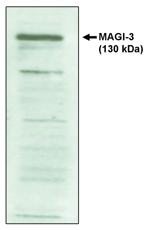 PAM16 Antibody - Western blot of MAGI-3, PDZ 4-5 antibody on cell lysates transfected with full-length human MAGI-3 protein.