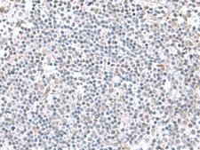 PAM16 Antibody - Immunohistochemistry of paraffin-embedded Human tonsil tissue  using PAM16 Polyclonal Antibody at dilution of 1:60(×200)