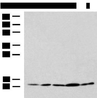 PAM16 Antibody - Western blot analysis of HL-60 Hela Jurkat LNCAP HepG2 cell lysates  using PAM16 Polyclonal Antibody at dilution of 1:900
