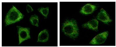 Pan Cytokeratin Antibody - Cytokeratin 5 Antibody in Immunofluorescence (IF)