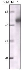 Pan Cytokeratin Antibody - Cytokeratin 5 Antibody in Western Blot (WB)