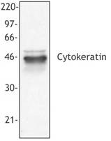 Pan Cytokeratin Antibody - Hela cell extract was resolved by electrophoresis, transferred to nitrocellulose and probed with monoclonal ant-cytokeratin antibody (clone C-11).