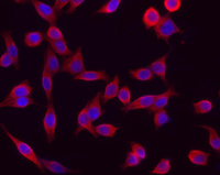 Pan Cytokeratin Antibody - Hela cells stained with purified mouse monoclonal antibody against pan Cytokeratin (clone C-11), followed by Rhodamine Red-X conjugated Donkey anti-mouse IgG and DAPI
