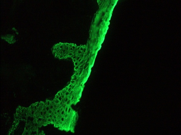 Pan Cytokeratin Antibody - Immunofluorescent staining on frozen sections of human skin
