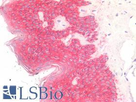 Pan Cytokeratin