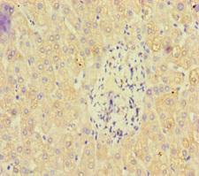 PAN2 / USP52 Antibody - Immunohistochemistry of paraffin-embedded human liver tissue at dilution of 1:100