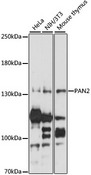 PAN2 / USP52 Antibody - Western blot analysis of extracts of various cell lines, using PAN2 antibody at 1:1000 dilution. The secondary antibody used was an HRP Goat Anti-Rabbit IgG (H+L) at 1:10000 dilution. Lysates were loaded 25ug per lane and 3% nonfat dry milk in TBST was used for blocking. An ECL Kit was used for detection and the exposure time was 15s.