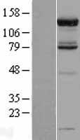 PAN2 / USP52 Protein - Western validation with an anti-DDK antibody * L: Control HEK293 lysate R: Over-expression lysate