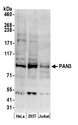 PAN3 Antibody - Detection of human PAN3 by western blot. Samples: Whole cell lysate (50 µg) from HeLa, HEK293T, and Jurkat cells prepared using NETN lysis buffer. Antibody: Affinity purified rabbit anti-PAN3 antibody used for WB at 0.1 µg/ml. Detection: Chemiluminescence with an exposure time of 3 minutes.