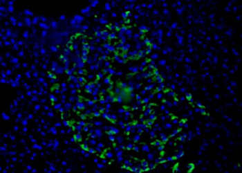 Pancreas Marker HPa1 Antibody - HPa1 Antibody (DHIC2-2C12) - HPa1 antibody (DHIC2-2C12) - Immunofluorescence on frozen section of human pancreas.  This image was taken for the unconjugated form of this product. Other forms have not been tested.