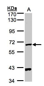 PANK1 / PANK Antibody - Sample (30 ug whole cell lysate). A: Hep G2 . 7.5% SDS PAGE. Pantothenate Kinase / PANK antibody diluted at 1:5000