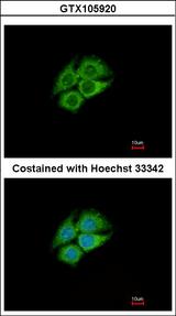 PANK1 / PANK Antibody - Immunofluorescence of methanol-fixed Hep G2 using PANK1 antibody at 1:500 dilution.