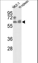 PANK1 / PANK Antibody - Western blot of hPANK1-R90 in MCF-7 cell line and mouse spleen tissue lysates (35 ug/lane). PANK1 (arrow) was detected using the purified antibody.