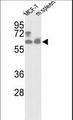 PANK1 / PANK Antibody - Western blot of hPANK1-R90 in MCF-7 cell line and mouse spleen tissue lysates (35 ug/lane). PANK1 (arrow) was detected using the purified antibody.