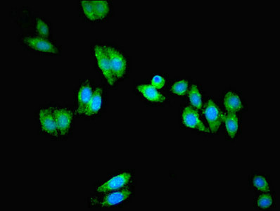 PANK1 / PANK Antibody - Immunofluorescent analysis of HepG2 cells using PANK1 Antibody at dilution of 1:100 and Alexa Fluor 488-congugated AffiniPure Goat Anti-Rabbit IgG(H+L)