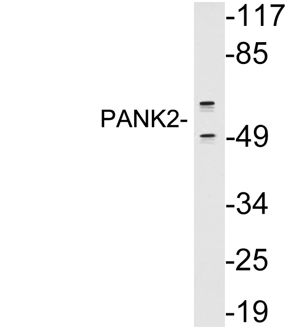 PANK2 Antibody - Western blot analysis of lysates from A549 cells, using PANK2 antibody.