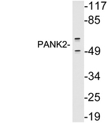 PANK2 Antibody - Western blot analysis of lysates from A549 cells, using PANK2 antibody.