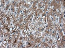 PANK2 Antibody - IHC of paraffin-embedded Human liver tissue using anti-PANK2 mouse monoclonal antibody. (Dilution 1:50).
