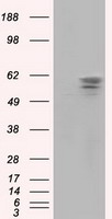 PANK2 Antibody - HEK293T cells were transfected with the pCMV6-ENTRY control (Left lane) or pCMV6-ENTRY PANK2 (Right lane) cDNA for 48 hrs and lysed. Equivalent amounts of cell lysates (5 ug per lane) were separated by SDS-PAGE and immunoblotted with anti-PANK2.