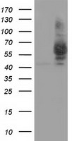 PANK2 Antibody - HEK293T cells were transfected with the pCMV6-ENTRY control (Left lane) or pCMV6-ENTRY PANK2 (Right lane) cDNA for 48 hrs and lysed. Equivalent amounts of cell lysates (5 ug per lane) were separated by SDS-PAGE and immunoblotted with anti-PANK2.