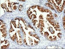 PANK2 Antibody - IHC of paraffin-embedded Human prostate tissue using anti-PANK2 mouse monoclonal antibody. (Dilution 1:50).