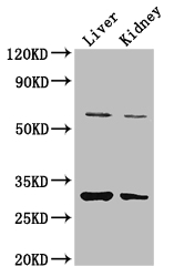 PANK2 Antibody - Positive WB detected in:Mouse liver tissue,Mouse kidney tissue;All lanes: PANK2 antibody at 3.4ug/ml;Secondary;Goat polyclonal to rabbit IgG at 1/50000 dilution;Predicted band size: 63,31,50,51 kDa;Observed band size: 63,31 kDa;