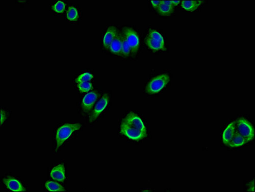 PANK2 Antibody - Immunofluorescent analysis of HepG2 cells using PANK2 Antibody at a dilution of 1:100 and Alexa Fluor 488-congugated AffiniPure Goat Anti-Rabbit IgG(H+L)
