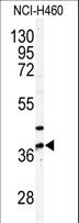 PANK3 Antibody - Western blot of anti-PANK3 Antibody in NCI-H460 cell line lysates (35 ug/lane). PANK3(arrow) was detected using the purified antibody.