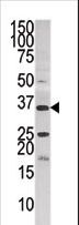 PANK3 Antibody - Western blot of anti-PANK3 in HepG2 cell line lysate (35 ug/lane). PANK3(arrow) was detected using the purified antibody.