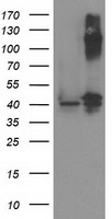PANK3 Antibody - HEK293T cells were transfected with the pCMV6-ENTRY control (Left lane) or pCMV6-ENTRY PANK3 (Right lane) cDNA for 48 hrs and lysed. Equivalent amounts of cell lysates (5 ug per lane) were separated by SDS-PAGE and immunoblotted with anti-PANK3.