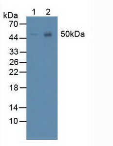 PANX1 / Pannexin 1 Antibody - Western Blot; Lane1: Human SK-N-SH Cells; Lane2: Human U-87MG Cells.