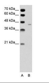 PANX1 / Pannexin 1 Antibody - A: Marker, B: Jurkat Cell Lysate.  This image was taken for the unconjugated form of this product. Other forms have not been tested.