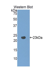 PANX1 / Pannexin 1 Antibody - Western blot of recombinant PANX1 / Pannexin 1.  This image was taken for the unconjugated form of this product. Other forms have not been tested.