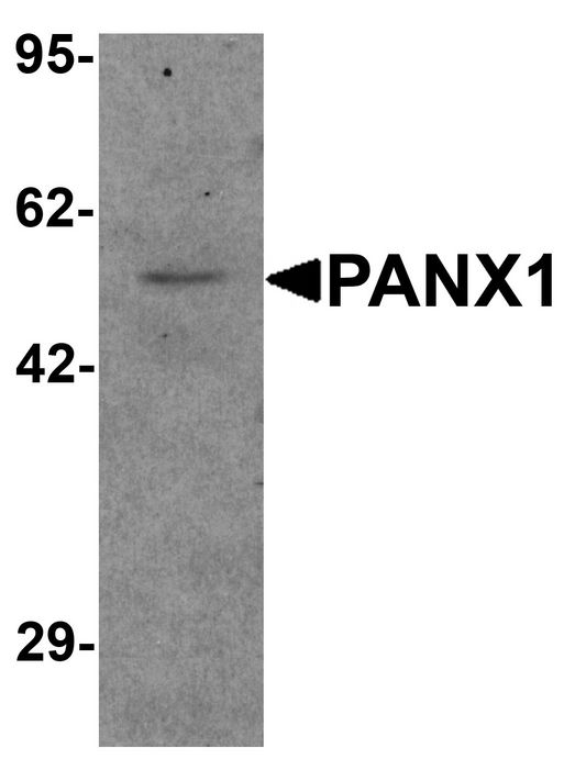 PANX1 / Pannexin 1 Antibody - Western blot analysis of PANX1 in human ovary tissue lysate with PANX1 antibody at 1 ug/ml.