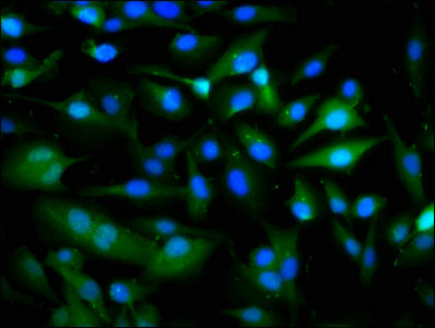 PANX1 / Pannexin 1 Antibody - Immunofluorescence staining of U251 cells with PANX1 Antibody at 1:266, counter-stained with DAPI. The cells were fixed in 4% formaldehyde, permeabilized using 0.2% Triton X-100 and blocked in 10% normal Goat Serum. The cells were then incubated with the antibody overnight at 4°C. The secondary antibody was Alexa Fluor 488-congugated AffiniPure Goat Anti-Rabbit IgG(H+L).