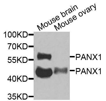 PANX1 / Pannexin 1 Antibody - Western blot analysis of extracts of various cell lines, using PANX1 antibody at 1:1000 dilution. The secondary antibody used was an HRP Goat Anti-Rabbit IgG (H+L) at 1:10000 dilution. Lysates were loaded 25ug per lane and 3% nonfat dry milk in TBST was used for blocking. An ECL Kit was used for detection and the exposure time was 30s.