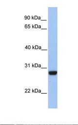 PAOX / PAO Antibody - Fetal muscle lysate. Antibody concentration: 1.0 ug/ml. Gel concentration: 12%.  This image was taken for the unconjugated form of this product. Other forms have not been tested.