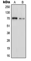 PAOX / PAO Antibody - Western blot analysis of PAOX expression in Jurkat (A); HT1080 (B) whole cell lysates.